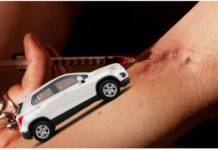 Needle and white 2019 Chevy Trax being injected into arm