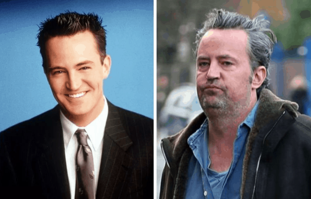 Comparison of Mathew Perry from the 90s and now 