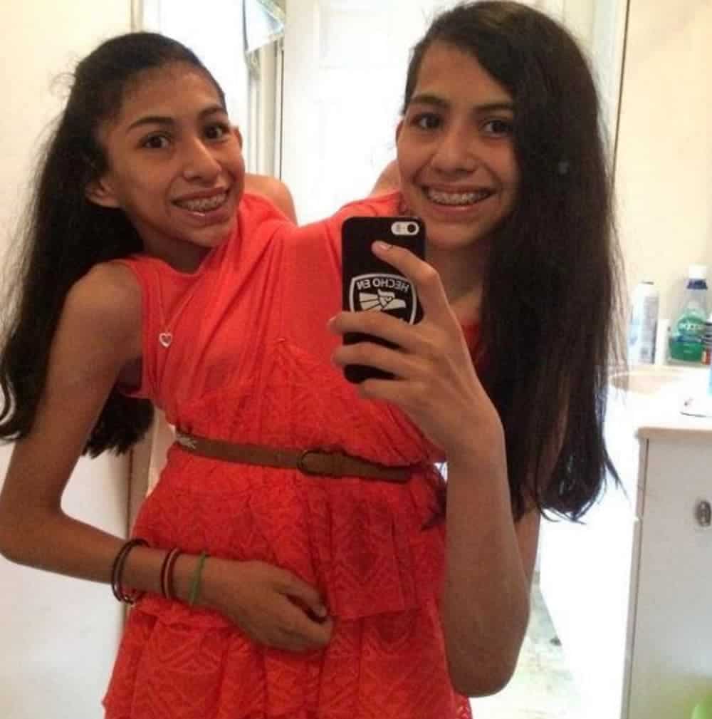 Conjoined twins are taking a mirror selfie in a red dress.